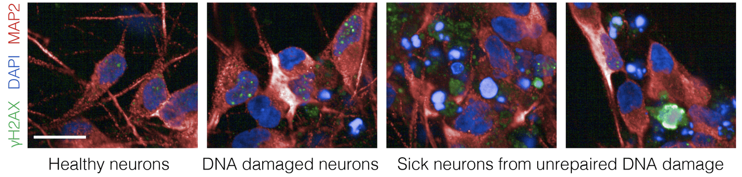 Comparison of healthy neurons, DNA-damaged neurons and neurons affected by unrepaired DNA damage